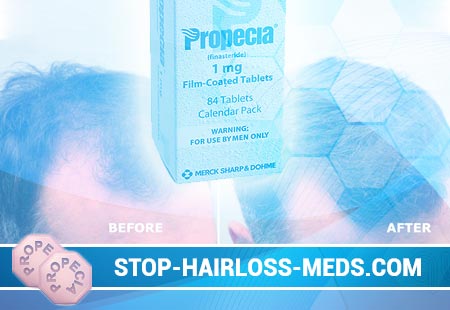 propecia